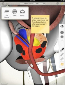 urosketch 3D